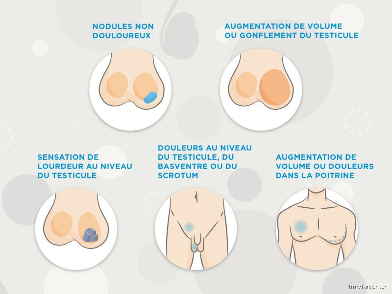 Quand faut-il vider les testicules ?