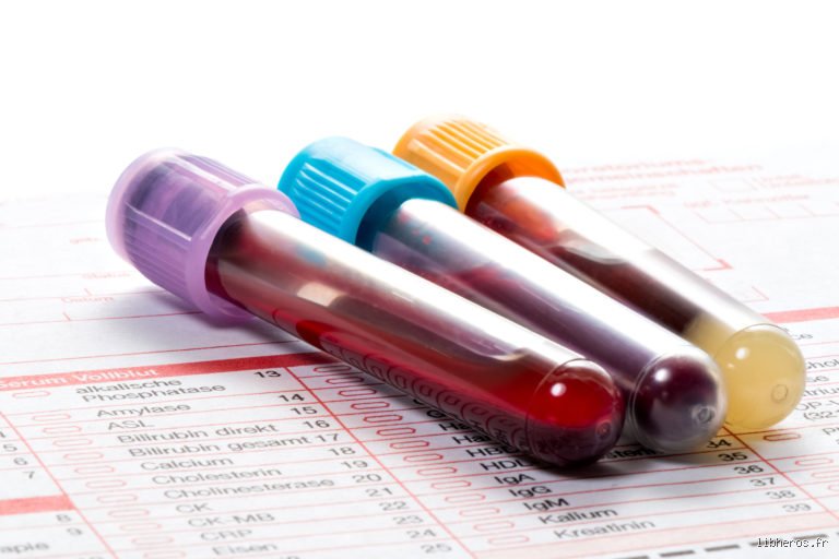 Quand on a un cancer, est-ce que ça se voit dans les prises de sang ? La vérité technique derrière le diagnostic biologique