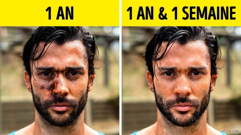 Que se passe-t-il après deux semaines sans douche ? Les mécanismes invisibles d’une métamorphose cutanée radicale