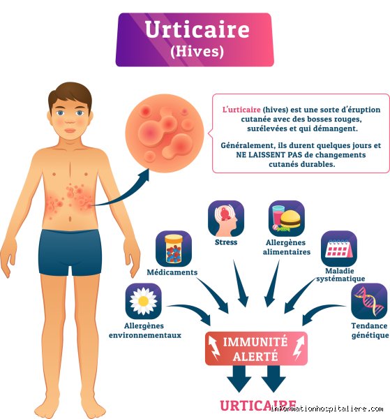 Quel cancer donne de l'urticaire ?