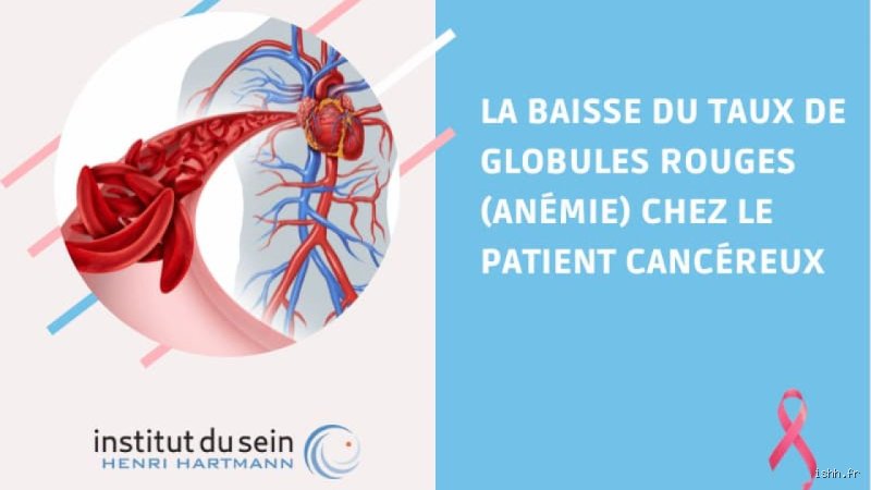 Quel cancer peut provoquer l'anémie ? Comprendre les liens complexes entre tumeurs malignes et chute des globules rouges