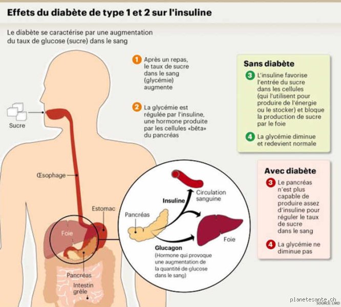 Quel est l'organe qui provoque le diabète ? Tout comprendre sur le rôle occulte du pancréas et de ses complices