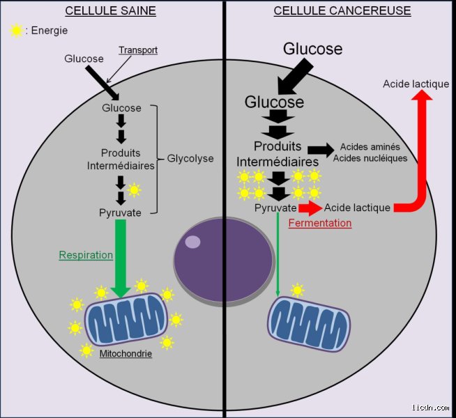 Quel est le carburant du cancer ? La vérité brute sur le métabolisme des tumeurs au-delà du simple sucre
