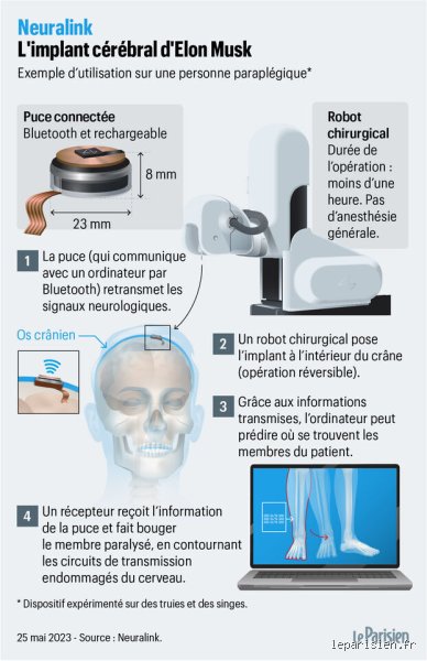 Quel est le diagnostic médical d'Elon Musk ? Enquête sur la neurodivergence du patron de Tesla et SpaceX