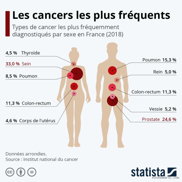 Quel est le meilleur cancer à avoir ? Pourquoi cette question taboue cache une réalité médicale complexe et des statistiques surprenantes