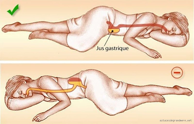 Quel est le meilleur côté pour dormir en cas de pancréatite pour soulager la douleur et accélérer la guérison nocturne ?