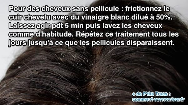 Quel est le meilleur remède contre les pellicules ?