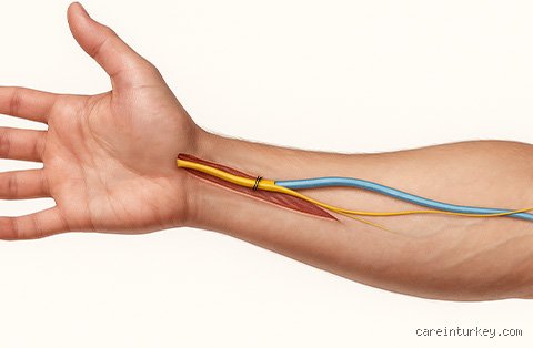 Quel est le moyen le plus rapide de régénérer les nerfs : les protocoles de pointe pour une guérison neuronale accélérée