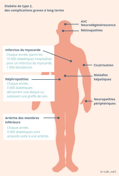 Quel est le stade final du diabète de type 2 et comment la médecine moderne définit-elle l'échec pancréatique terminal ?