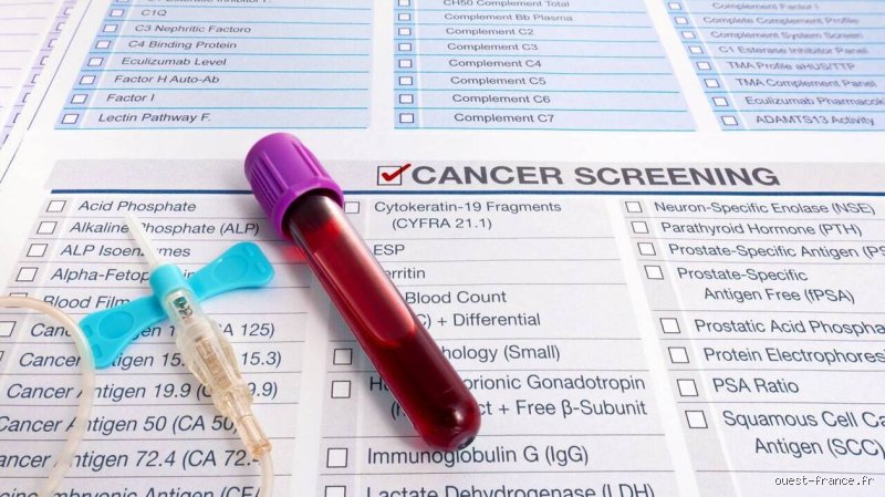 Quel est le test sanguin de référence pour le cancer ? La vérité sur les limites actuelles et les espoirs de la biopsie liquide