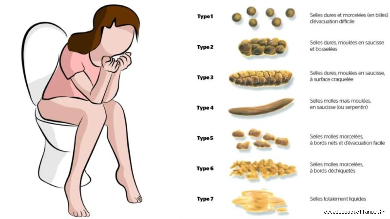 Quel examen pour détecter le côlon irritable ? Le parcours du combattant pour un diagnostic enfin fiable