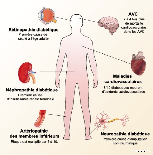Quel organe est touché en premier par le diabète ? La réponse surprenante qui bouscule enfin les idées reçues
