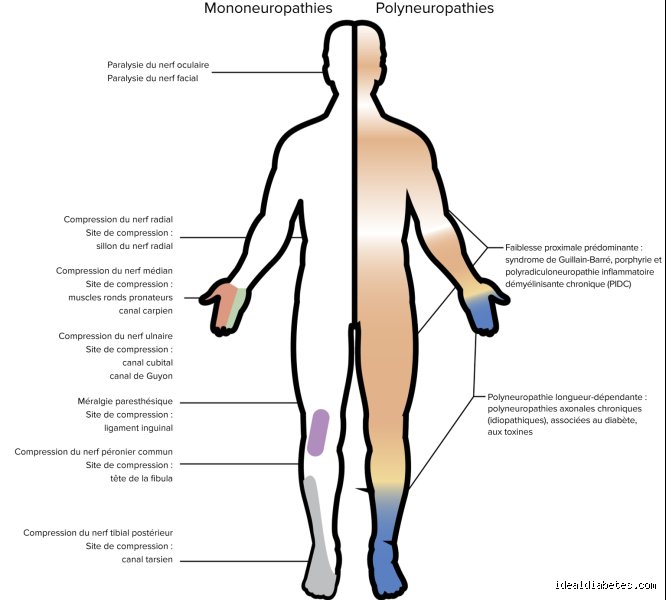 Quel organe est touché par la neuropathie ? Tout comprendre sur ce court-circuit du système nerveux périphérique
