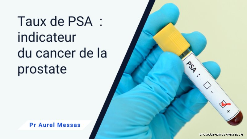 Quel taux de PSA libre à 75 ans ? Comprendre enfin les chiffres pour éviter les angoisses inutiles