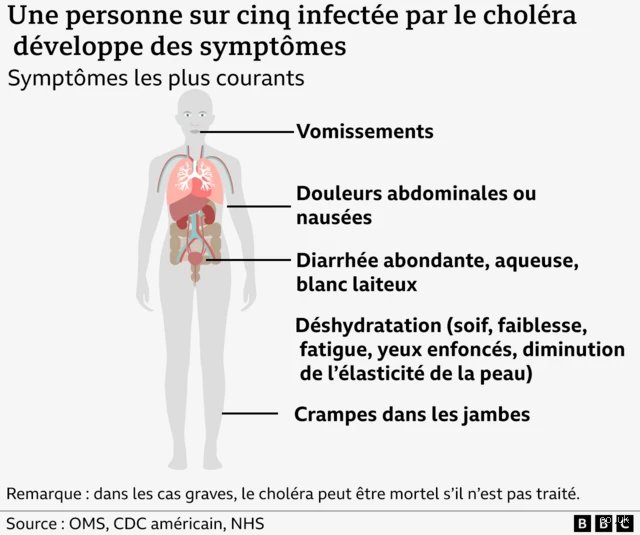 Quelle est l'infection mortelle causée par les bactéries dans l'eau ? Le guide complet sur les risques hydriques invisibles