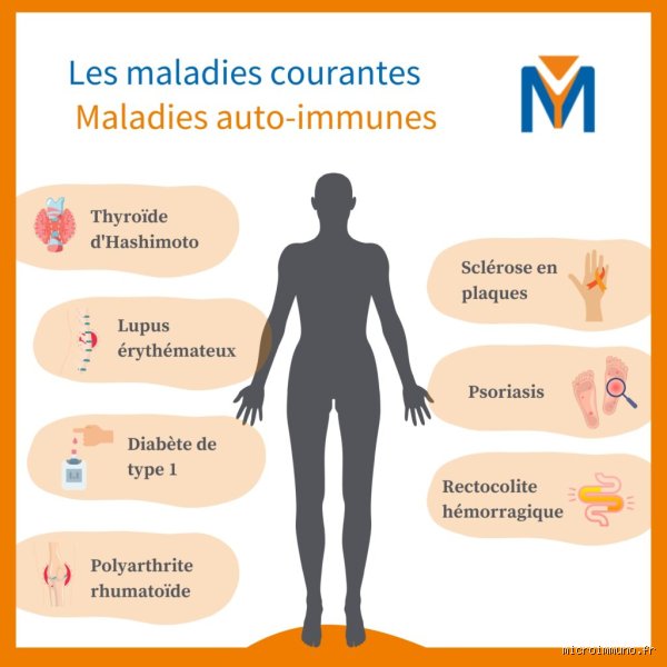 Quelle est la maladie auto-immune qui affecte le plus souvent les articulations ? Analyse complète du grand fléau rhumatismal