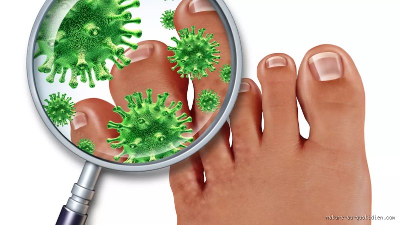 Quelle est la recette de grand mère pour la mycose des pieds ? Le guide complet pour assainir vos orteils naturellement