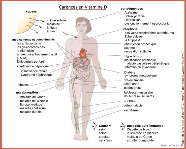 Quelle maladie auto-immune est liée à la vitamine D ? Le lien complexe entre une hormone solaire et nos défenses
