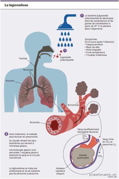Quelle maladie est causée par la bactérie dans l'eau ? Le guide noir des pathogènes invisibles qui hantent nos robinets
