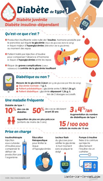 Quelles maladies peuvent déclencher un diabète de type 1 : la piste virale et immunitaire enfin expliquée