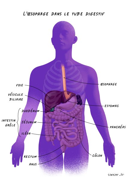 Quelles parties du corps sont touchées par le cancer de l'œsophage ? Comprendre l'étendue réelle de la maladie au-delà du simple conduit alimentaire