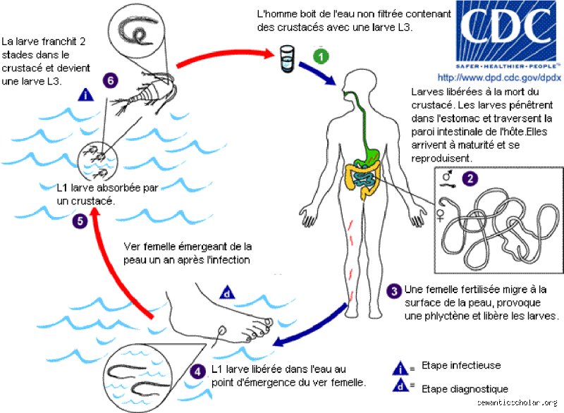 Quelles sont 3 maladies liées à l'eau ? Comprendre les risques majeurs pour la santé mondiale et les enjeux de l'accès à l'eau potable