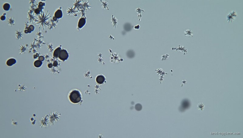 Quelles sont les bactéries les plus courantes dans ma piscine et comment éviter que votre bassin ne devienne un bouillon de culture ?