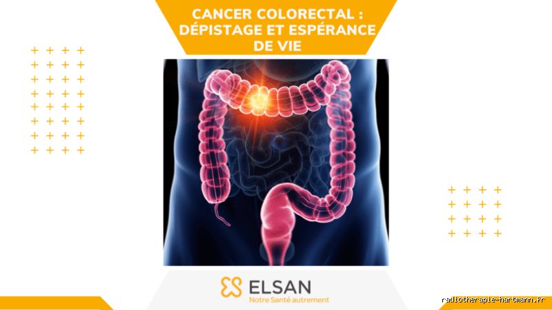 Quelles sont les chances de guérir d'un cancer du colon ? Tout ce que vous devez savoir sur le pronostic actuel