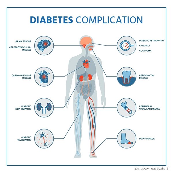 Quelles sont les complications à long terme du diabète de type 1 ? Ce que la médecine moderne ne vous dit pas toujours