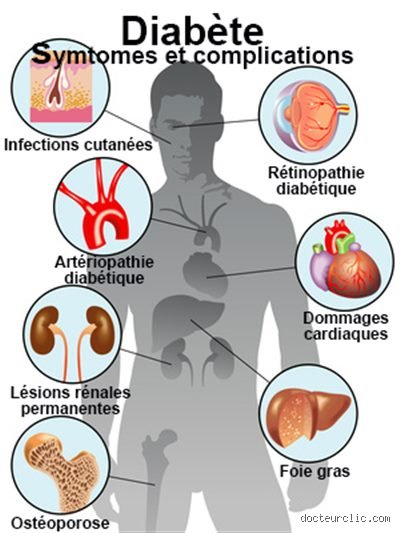 Quelles sont les douleurs provoquées par le diabète type 2 ? Le guide complet pour identifier les signaux d'alarme invisibles