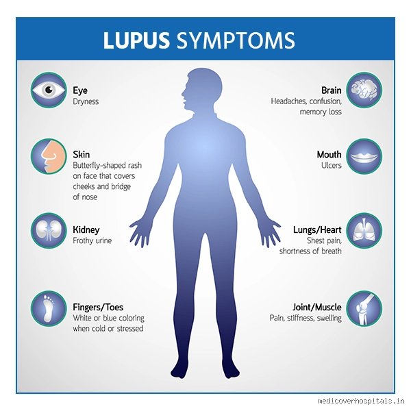 Quelles sont les sensations liées au lupus : comprendre ce que ressentent réellement les patients au quotidien