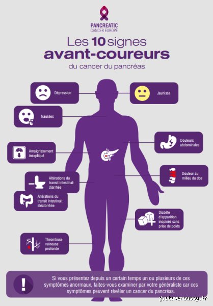 Quels sont les 10 signes du cancer du pancréas ? Reconnaître les alertes silencieuses pour agir à temps