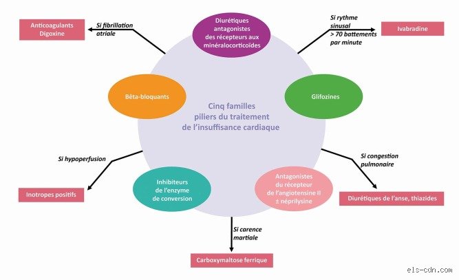 Quels sont les 4 médicaments miracles contre l'insuffisance cardiaque ? Le guide complet sur la révolution thérapeutique actuelle
