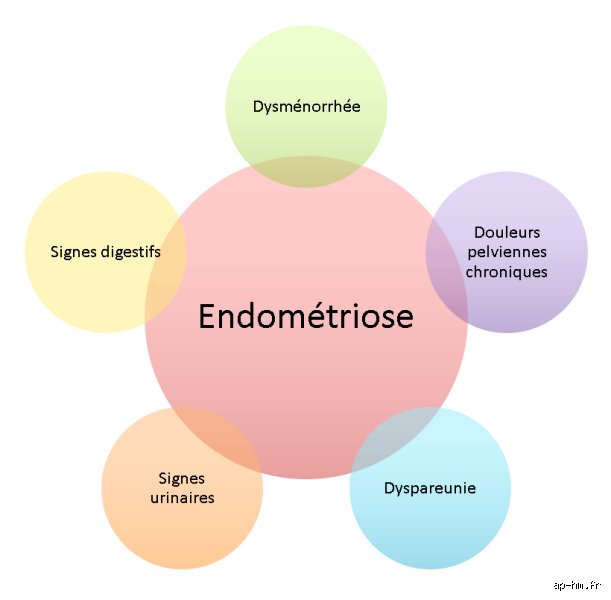 Quels sont les 5 D de l'endométriose : comprendre enfin ces symptômes qui bousculent la vie de millions de femmes