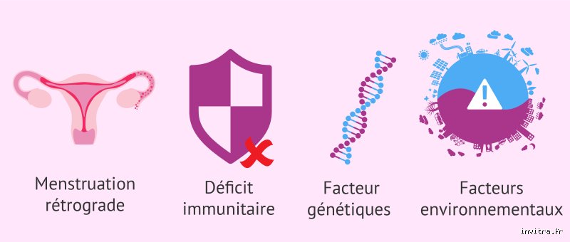 Quels sont les facteurs déclencheurs d'une poussée d'endométriose ? Comprendre enfin les mécanismes de la douleur inflammatoire