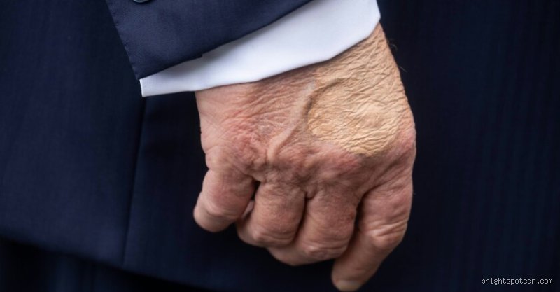 Quels sont les problèmes de santé de Donald Trump : entre bulletins officiels laconiques et obsessions pour les gènes supérieurs
