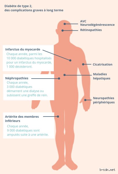 Quels sont les signes du diabète au stade terminal ? Comprendre l'évolution ultime de la maladie pour mieux accompagner