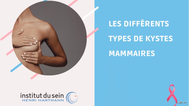 Quels sont les signes indiquant qu'un kyste est cancéreux ? Le guide pour différencier une boule bénigne d'une tumeur suspecte