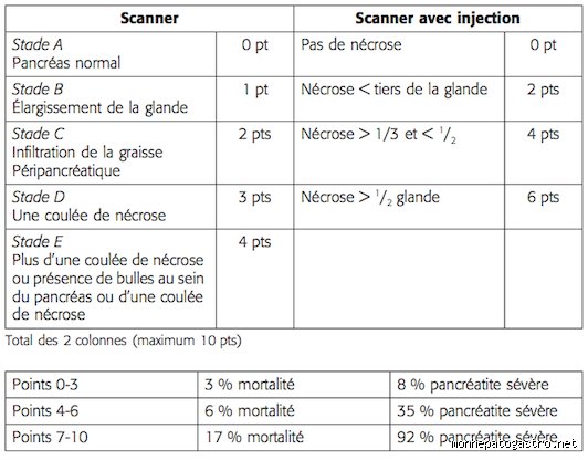 Quels sont les stades de la pancréatite ? Comprendre l'évolution d'une inflammation qui ne pardonne pas
