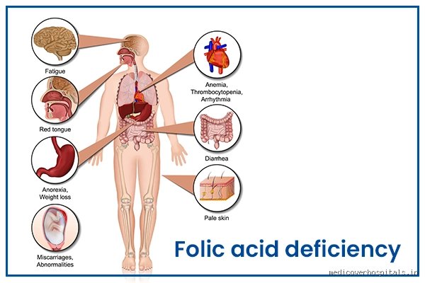 Pourquoi votre corps réclame de la vitamine B9 : les signes d'une carence en acide folique