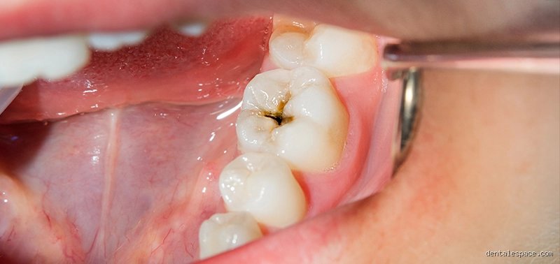 Quels sont les symptômes d'une infection silencieuse ? Le guide pour repérer ces signaux que votre corps essaie de cacher