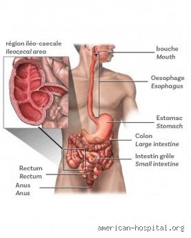 Quels sont les symptômes d'une inflammation du gros intestin ? Ce que votre corps tente désespérément de vous dire