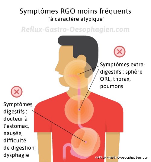 Quels sont les symptômes de douleurs à l'œsophage ? Comprendre les signaux d'alerte entre brûlures et spasmes