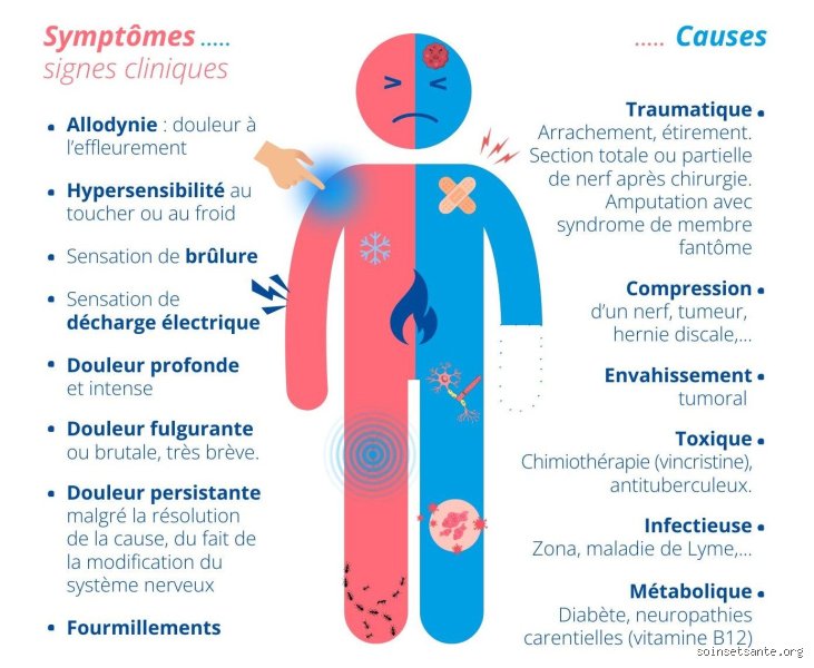 Quels sont les symptômes de lésions nerveuses ? Comprendre ces signaux d'alerte silencieux pour réagir avant qu'il ne soit trop tard