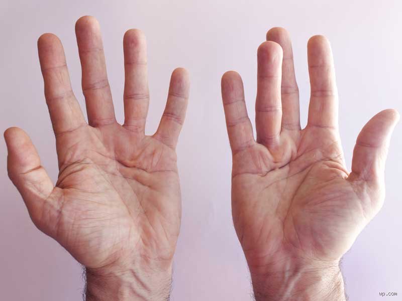 Quels sont les symptômes des mains diabétiques ? Le guide complet pour repérer les signaux d'alerte souvent ignorés