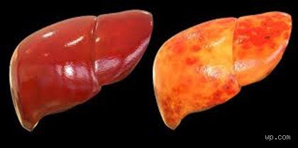 Un foie enflammé peut-il retrouver un état normal ? Ce que la science nous cache sur la régénération hépatique