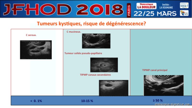 Un kyste pancréatique de 4 cm est-il gros ? Ce que la taille révèle réellement sur votre santé digestive