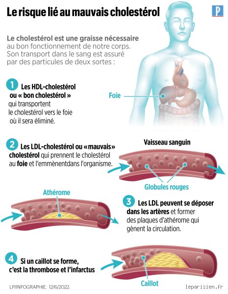 Un taux de cholestérol de 7 est-il dangereusement élevé ? Ce que votre médecin oublie de vous dire
