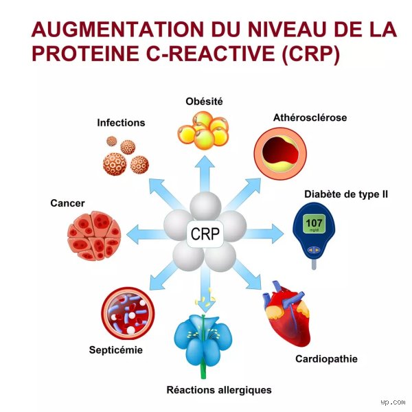 Un taux élevé de CRP signifie-t-il une septicémie ? La vérité sur ce marqueur biologique qui affole souvent les compteurs