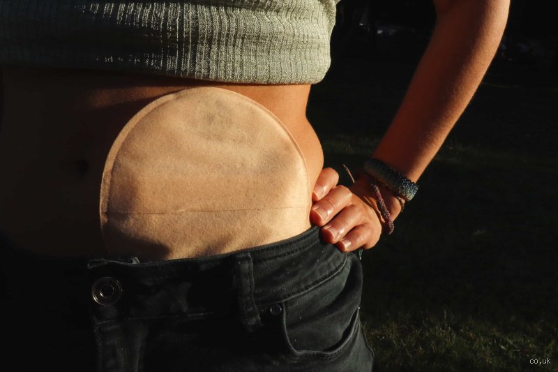 Pourquoi les sacs de colostomie sentent-ils si fort au moment de la vidange et comment dompter cette réalité biologique ?